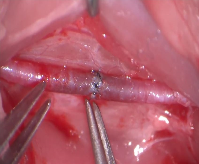 A Novel Approach Using a Silicone Tube to Assist Microsurgical Anastomosis Training in Animal Models
