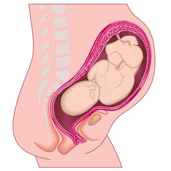 Can the Cervical Length Predict Procedure-Related Miscarriage?  