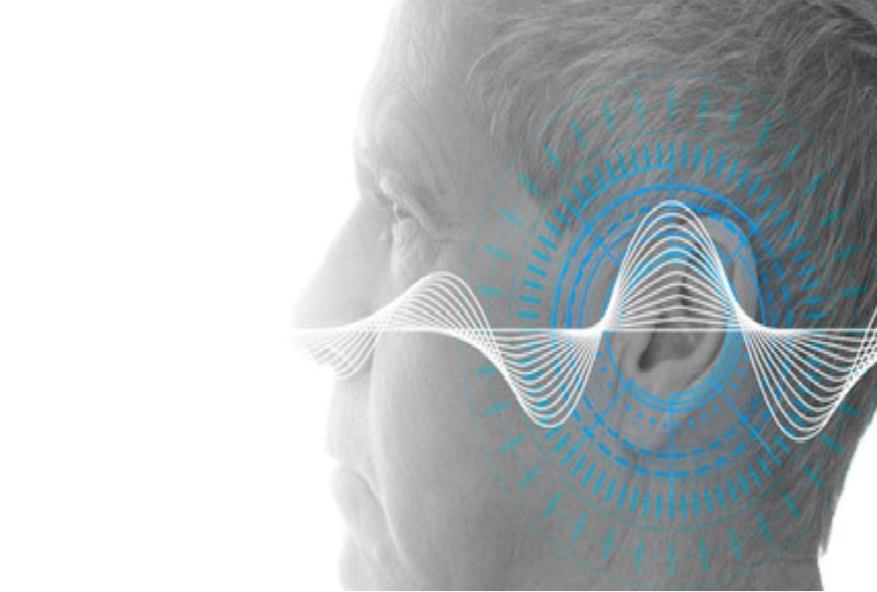 Auditory Evoked Potential in Patients with Tinnitus