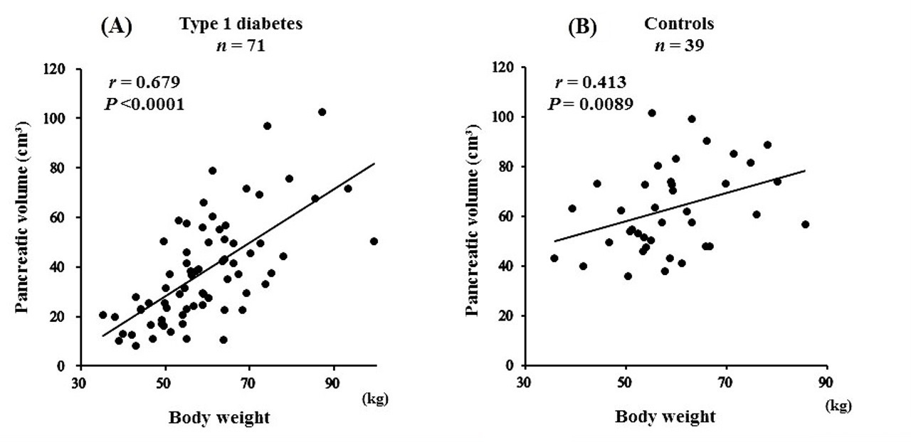 Relationship Between Islet Autoantibodies and Pancreatic Volume in Type 1 Diabetes in Japanese Population