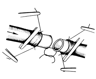 Neurohistological Evaluation of Sensory Nerve Regeneration in Canine Fasciocutaneous Free Flaps: Outcomes of Microsurgical Neurorrhaphy and Implications for Extremity Trauma Management