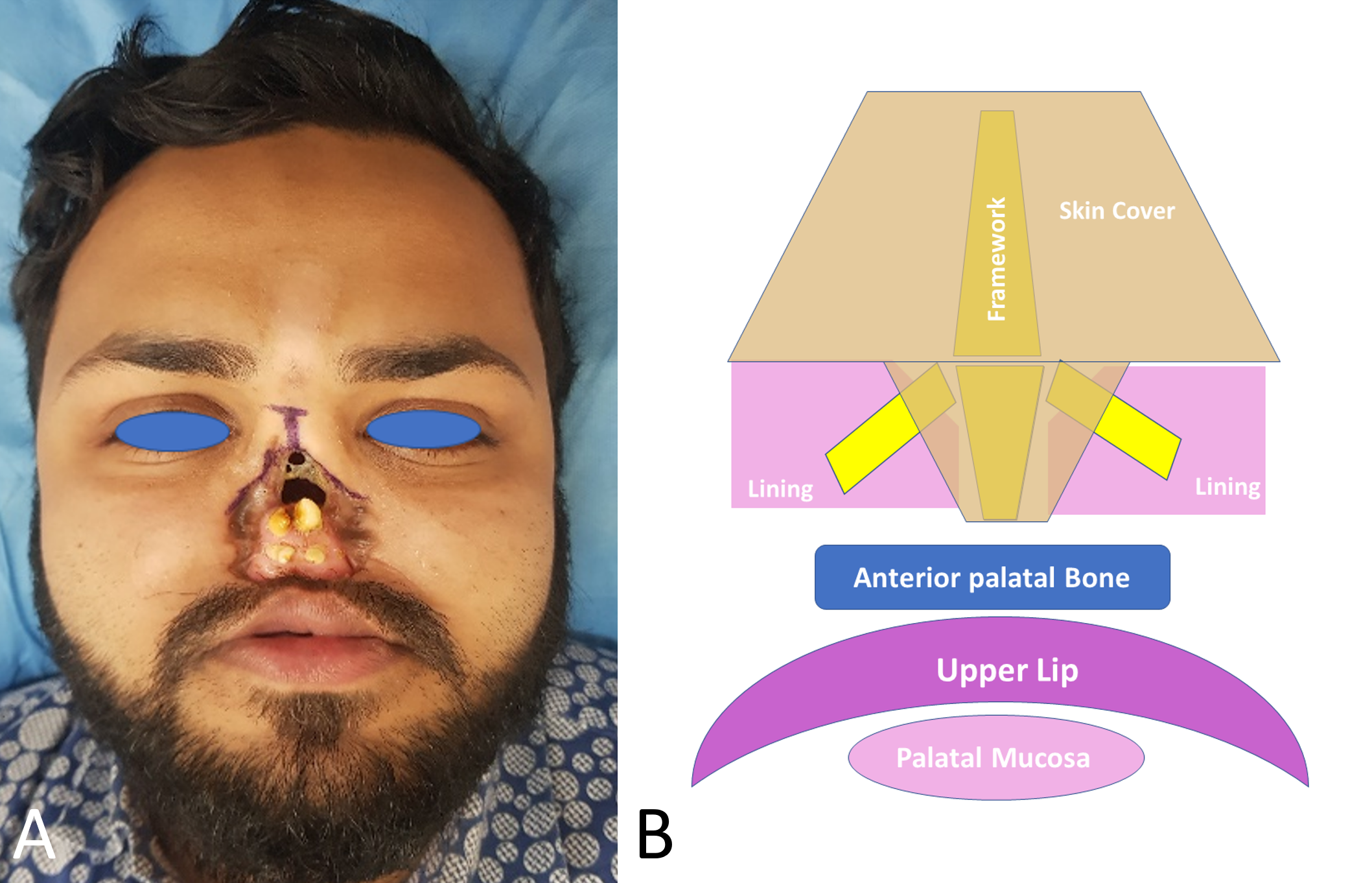翌日発送・インストラクションフラップ・ハーヴェスト/菅原康志 インストラクション・フラップ・ハーヴェスト \u003d Instruction Flap